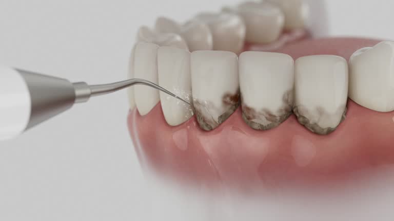 Trusted Tooth Extraction service in Central Garage, VA - Dentist Open Now